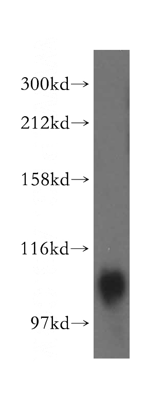 human liver tissue were subjected to SDS PAGE followed by western blot with Catalog No:108339(ATP13A1 antibody) at dilution of 1:500