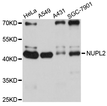 Western blot - NUPL2 Polyclonal Antibody 