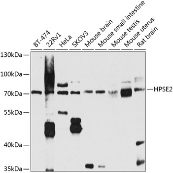 Western blot - HPSE2 Polyclonal Antibody 