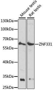 Western blot - ZNF331 Polyclonal Antibody 