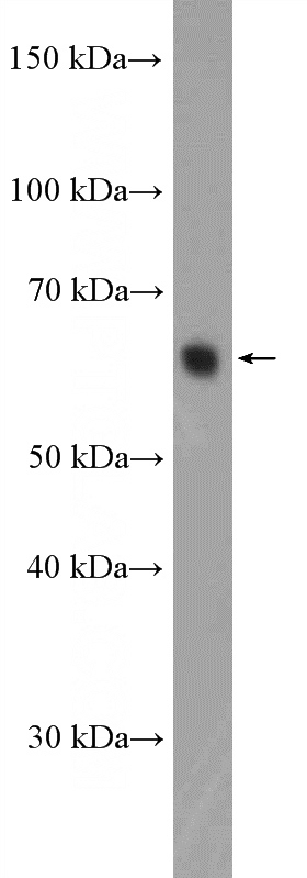 rat testis tissue were subjected to SDS PAGE followed by western blot with Catalog No:112053(KIFC1 Antibody) at dilution of 1:600