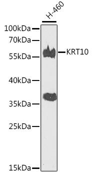 Western blot - KRT10 Polyclonal Antibody 