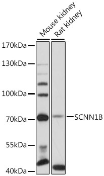 Western blot - SCNN1B Polyclonal Antibody 