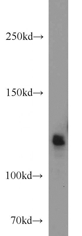 human brain tissue were subjected to SDS PAGE followed by western blot with Catalog No:114595(RBM10 antibody) at dilution of 1:1000