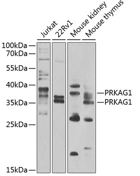 Western blot - PRKAG1 Polyclonal Antibody 