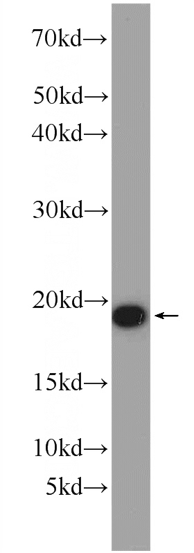 mouse brain tissue were subjected to SDS PAGE followed by western blot with Catalog No:108167(ARPC4 Antibody) at dilution of 1:1000