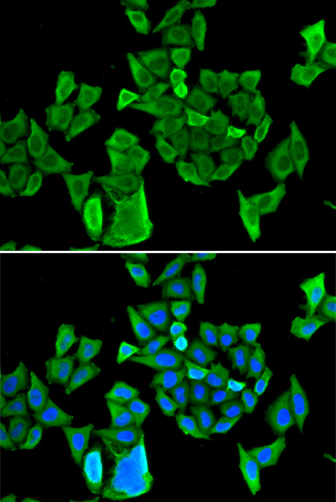 Immunofluorescence - CCAR1 Polyclonal Antibody 