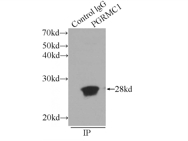 IP Result of anti-PGRMC1 (IP:Catalog No:113794, 3ug; Detection:Catalog No:113794 1:1000) with MCF-7 cells lysate 1600ug.