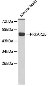 Western blot - PRKAR2B Polyclonal Antibody 