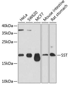 Western blot - SST Polyclonal Antibody 