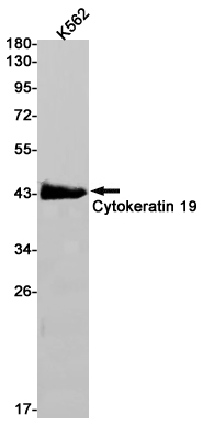 Western blot detection of Cytokeratin 19 in K562 cell lysates using Cytokeratin 19 Rabbit pAb(1:1000 diluted).Predicted band size:44kDa.Observed band size:41kDa.