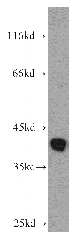 mouse kidney tissue were subjected to SDS PAGE followed by western blot with Catalog No:111174(GSNOR,ADH5 antibody) at dilution of 1:800