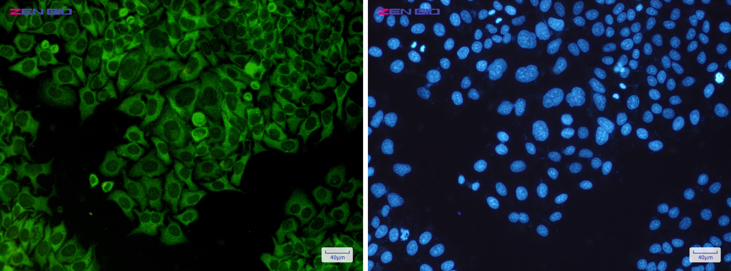 Immunocytochemistry of TNF Receptor II(green) in Hela cells using TNF Receptor II Rabbit pAb at dilution 1/50, and DAPI(blue)