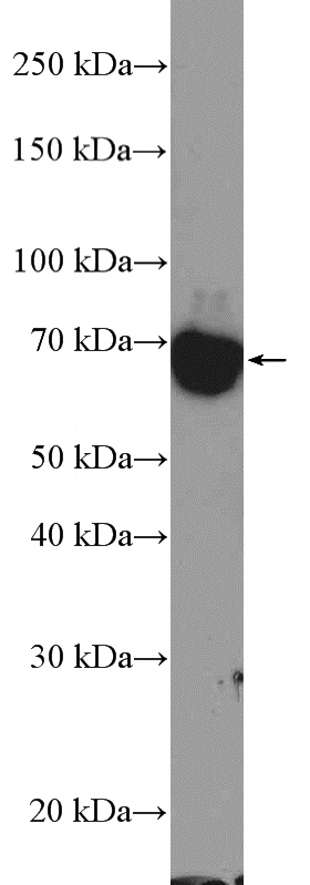 COLO 320 cells were subjected to SDS PAGE followed by western blot with Catalog No:116245(TOP1MT Antibody) at dilution of 1:1000