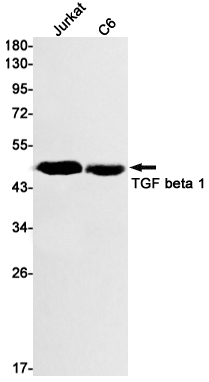 Western blot detection of TGF beta 1 in Jurkat,C6 cell lysates using TGF beta 1 Rabbit mAb(1:1000 diluted).Predicted band size:44kDa.Observed band size:44kDa.