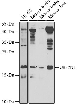 Western blot - UBE2NL Polyclonal Antibody 