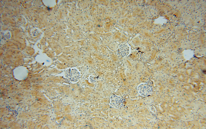 Immunohistochemical of paraffin-embedded human kidney using Catalog No:109580(CRTAP antibody) at dilution of 1:100 (under 10x lens)