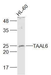 Fig1: Sample:; HL-60(Human) Cell Lysate at 30 ug; Primary: Anti-TAAL6 at 1/1000 dilution; Secondary: IRDye800CW Goat Anti-Rabbit IgG at 1/20000 dilution; Predicted band size: 24 kD; Observed band size: 24 kD
