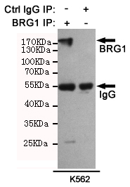 Immunoprecipitation analysis of K562 cell lysates using BRG1 mouse mAb (168196).