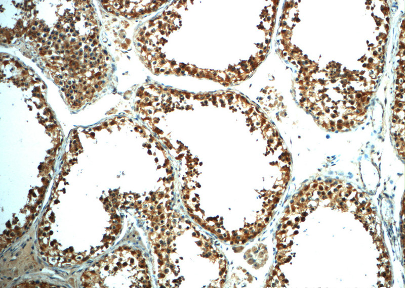 Immunohistochemistry of paraffin-embedded human testis slide using Catalog No:112144(LARG Antibody) at dilution of 1:50