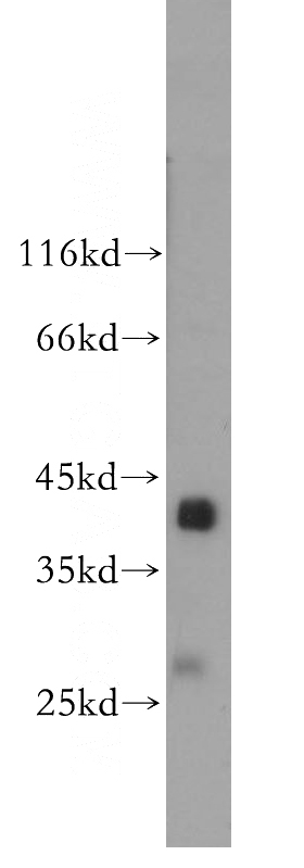 human skeletal muscle tissue were subjected to SDS PAGE followed by western blot with Catalog No:115163(SGCG antibody) at dilution of 1:600