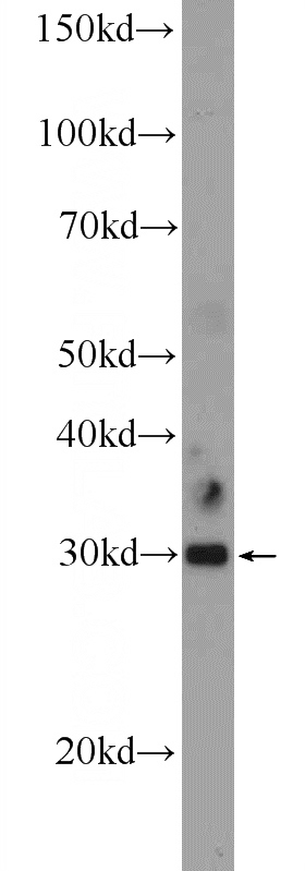 mouse brain tissue were subjected to SDS PAGE followed by western blot with Catalog No:108641(C11orf57 Antibody) at dilution of 1:300