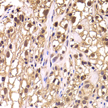 Immunohistochemistry - TCEB3 Polyclonal Antibody 