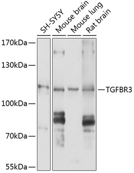 Western blot - TGFBR3 Polyclonal Antibody 
