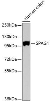 Western blot - SPAG1 Polyclonal Antibody 