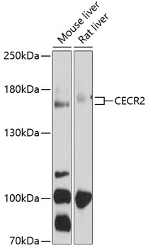 Western blot - CECR2 Polyclonal Antibody 