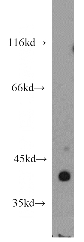 human skeletal muscle tissue were subjected to SDS PAGE followed by western blot with Catalog No:107704(ACTA1-Specific antibody) at dilution of 1:1000