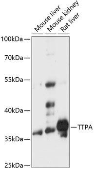 Western blot - TTPA Polyclonal Antibody 