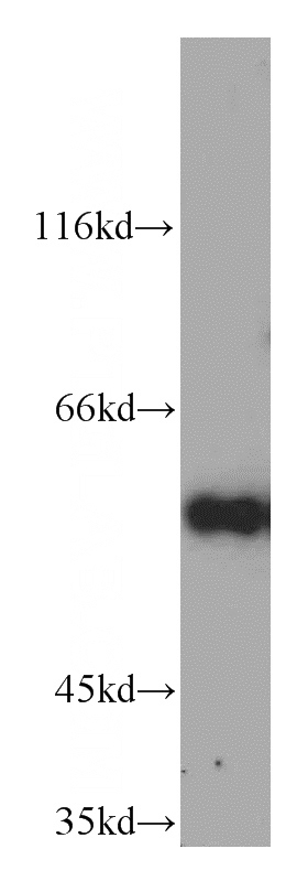 HepG2 cells were subjected to SDS PAGE followed by western blot with Catalog No:109662(CCNB1 antibody) at dilution of 1:500