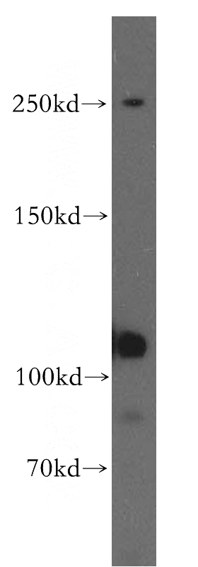 human testis tissue were subjected to SDS PAGE followed by western blot with Catalog No:110503(EXoc6 antibody) at dilution of 1:300