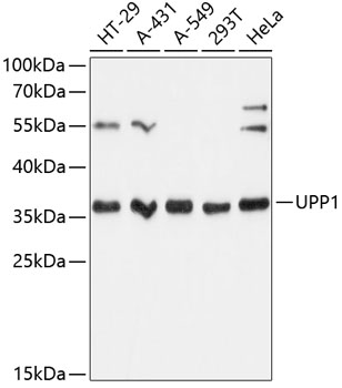 Western blot - UPP1 Polyclonal Antibody 