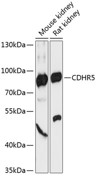 Western blot - CDHR5 Polyclonal Antibody 