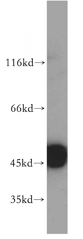 human skeletal muscle tissue were subjected to SDS PAGE followed by western blot with Catalog No:110253(ENO1 antibody) at dilution of 1:500