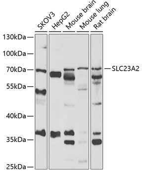 Western blot - SLC23A2 Polyclonal Antibody 