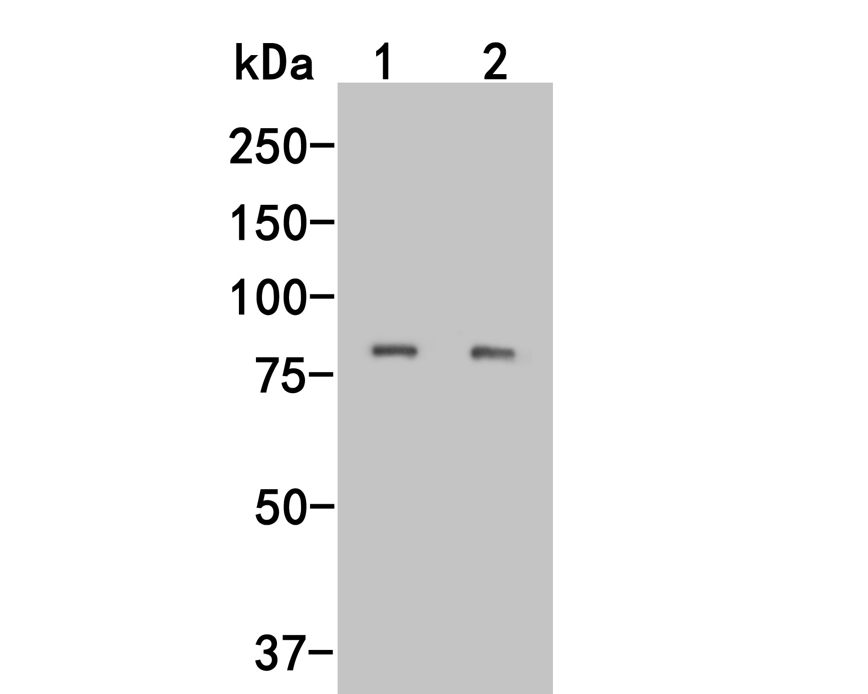 Fig1:; Western blot analysis of LRRN3 on different lysates. Proteins were transferred to a PVDF membrane and blocked with 5% BSA in PBS for 1 hour at room temperature. The primary antibody ( 1/500) was used in 5% BSA at room temperature for 2 hours. Goat Anti-Mouse IgG - HRP Secondary Antibody (HA1006) at 1:5,000 dilution was used for 1 hour at room temperature.; Positive control:; Lane 1: SHSY5Ycell lysate; Lane 2: Rat testis tissue lysate