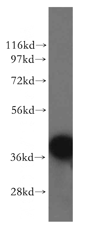 human brain tissue were subjected to SDS PAGE followed by western blot with Catalog No:114516(RAD51AP1 antibody) at dilution of 1:300