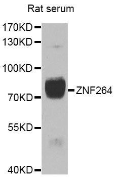 Western blot - ZNF264 Polyclonal Antibody 