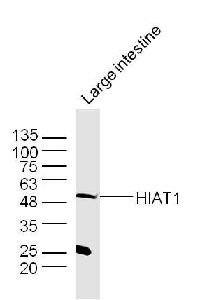 Fig2: Sample: Large intestine (Mouse) Lysate at 40 ug; Primary: Anti-HIAT1 at 1/300 dilution; Secondary: IRDye800CW Goat Anti-Rabbit IgG at 1/20000 dilution; Predicted band size: 53 kD; Observed band size: 53 kD