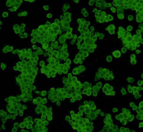Fig2: ICC staining 14-3-3 b/a in N2A cells (green). Cells were fixed in paraformaldehyde, permeabilised with 0.25% Triton X100/PBS.
