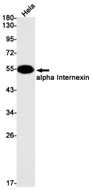 Western blot detection of alpha Internexin in Hela cell lysates using alpha Internexin Rabbit mAb(1:1000 diluted).Predicted band size:55kDa.Observed band size:55kDa.