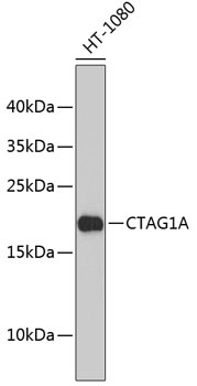 Western blot - CTAG1A Polyclonal Antibody 
