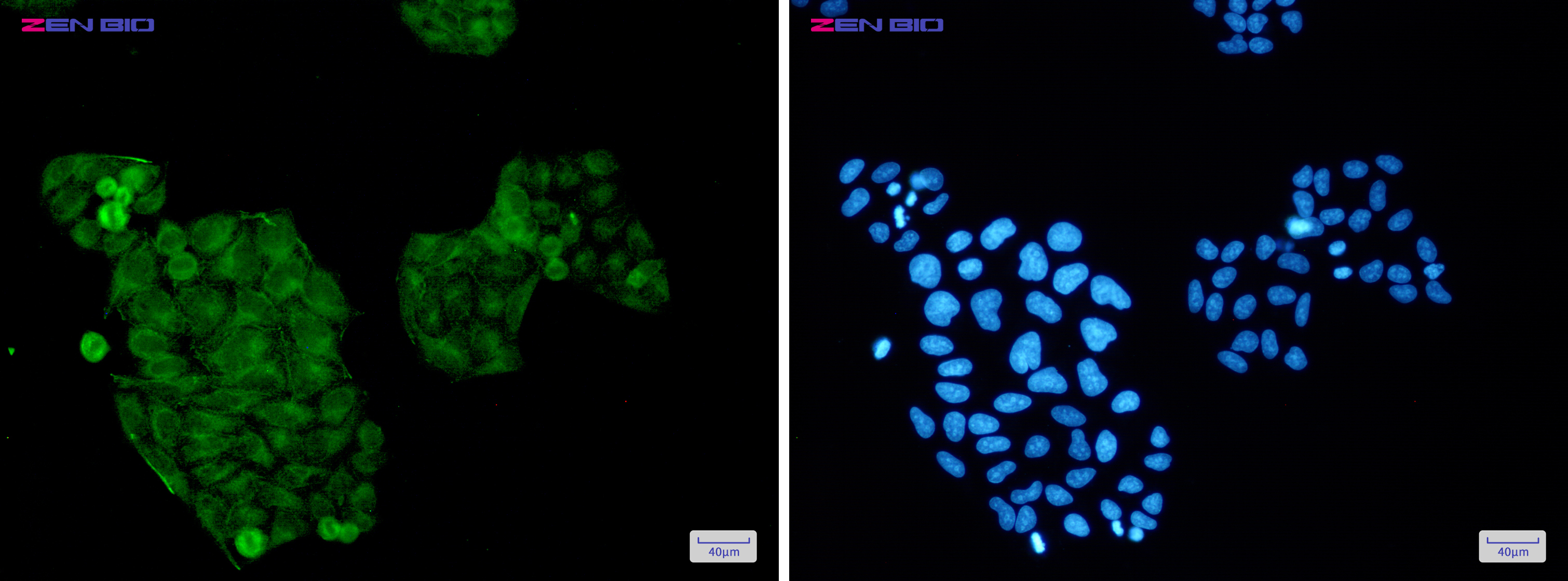 Immunocytochemistry of AKT1/2/3(green) in Hela cells using AKT Rabbit pAb at dilution 1/50, and DAPI(blue)