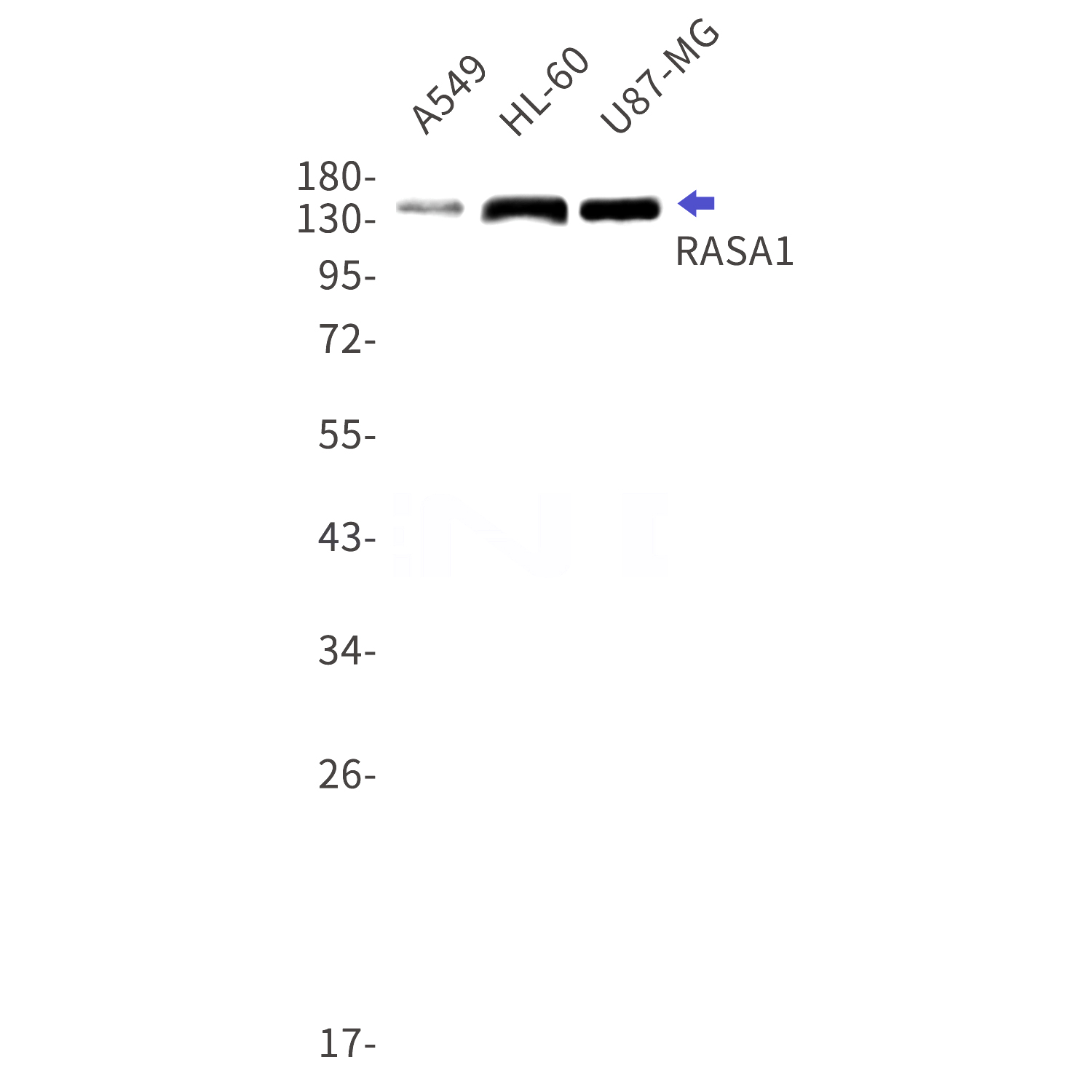 Anti-RASA1 Rabbit antibody