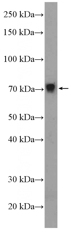 mouse liver tissue were subjected to SDS PAGE followed by western blot with Catalog No:117011(ZNF606 Antibody) at dilution of 1:600