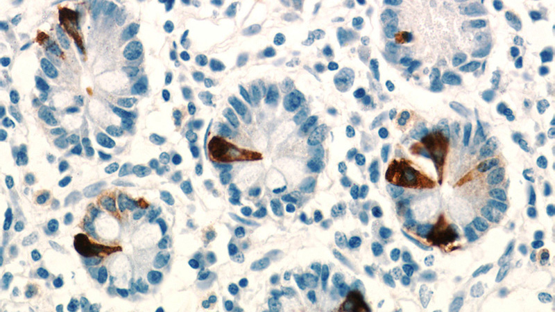 Immunohistochemical of paraffin-embedded human small intestine using Catalog No:109288(CHGA antibody) at dilution of 1:800 (under 40x lens)