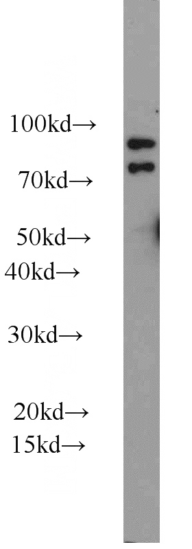 mouse testis tissue were subjected to SDS PAGE followed by western blot with Catalog No:111817(PLA2G6 antibody) at dilution of 1:1000